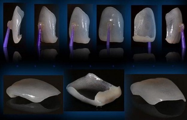 Толщина пластинок не больше 0,5 мм