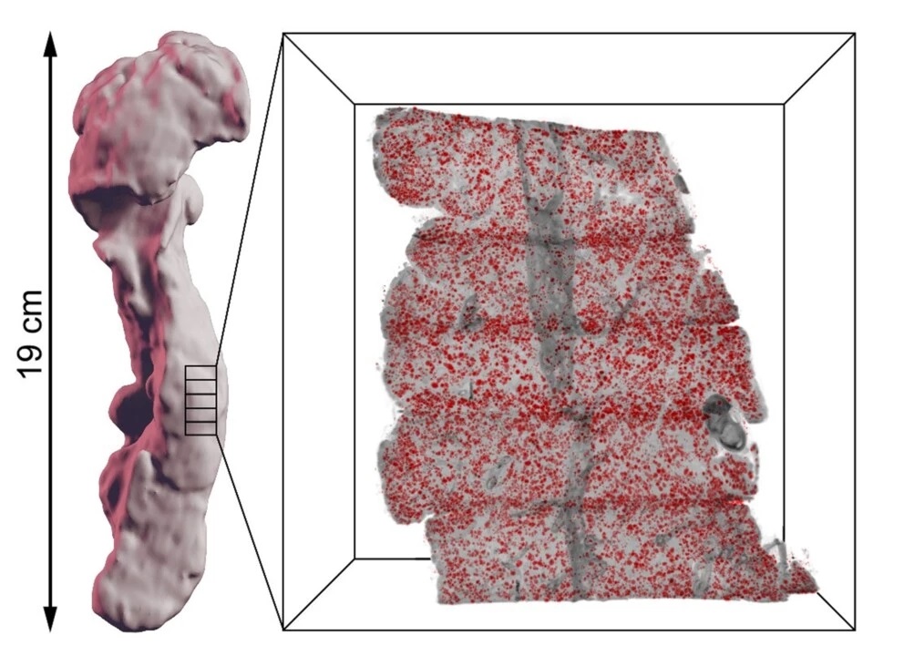 Иллюстрация того, как поджелудочная железа может быть разделена на более мелкие части, которые маркируются в зависимости от их специфических типов клеток с помощью окрашенных островков Лангерганса