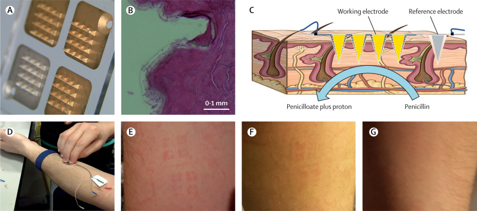 1570199428743702.jpg gr1.jpg